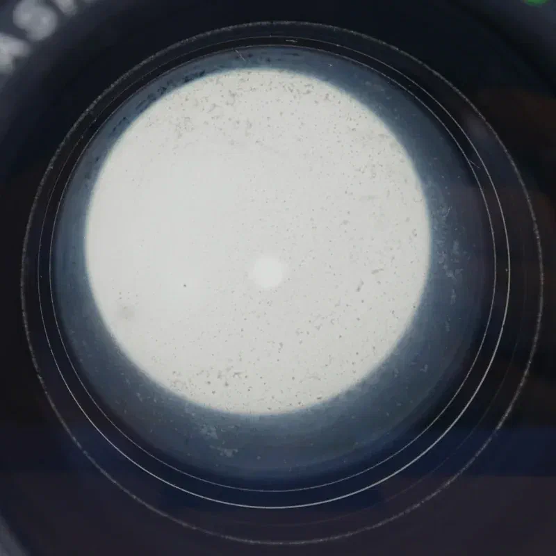lens fungus or haze
